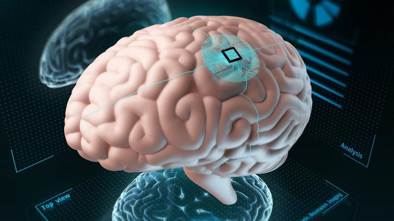 Pacientes com paralisia controlam computador por pensamento após implante cerebral-0