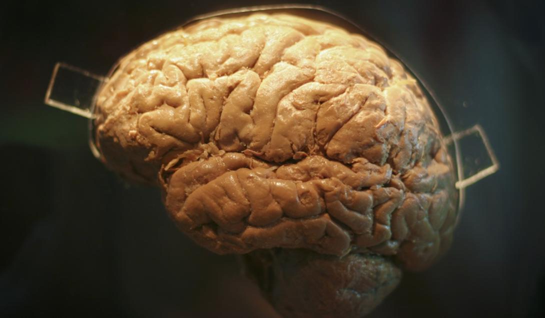 O mistério dos cérebros humanos conservados por 12 mil anos-0